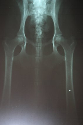 Dusty R�ntgenaufnahme * HD-A