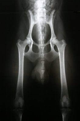 Logans R�ntgenbild * HD-B