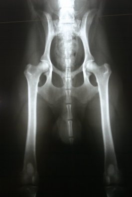 Liam's Röntgenaufnahme * HD-A